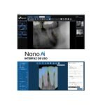 Sensor_Intraoral_Nanopix_1.5